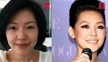 太阳成集团tyc7111cc:肾阳虚吃什么药最好?男人养肾最佳10食物(图2) 太阳成集团tyc7111cc